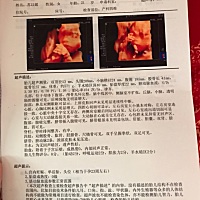 倒计时了、好想知道是男孩女孩😁