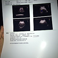 38周多了，宝宝好像还不愿意出来