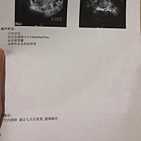 2月8号最后一次例假，今天见红去医院，结果如图，医生说没有看到卵黄囊，好着急，特别想要孩子。
