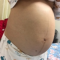 37 5，离预产期越来越近啦，好开心好期待，愿宝宝一切健康平安。^_^