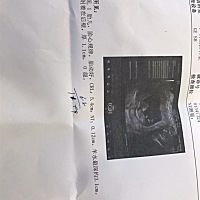 12周nt，能看出性别吗？