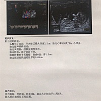 是男孩女孩，宝妈们。