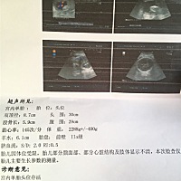 哪位大神给看看男孩女孩34周