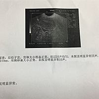 迟了6日还未来，验了2次都不是怀孕，这是快来月经还是怀孕？10mm正常吗