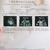 哪位大神看得出是男是女吗？