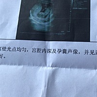 能帮我看出是男女吗？迫切希望是女孩👧