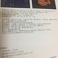 宝妈们帮我看看是男宝还是女宝，这几天总是梦到宝宝要出来了，心情好焦虑不安，是不是我想太多了