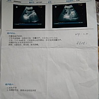 各位有经验的帮忙看看男宝女宝