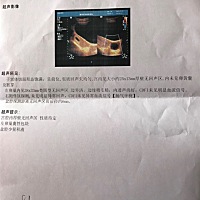 有没有类似情况的，最后一次月经2月3日，今天3月27做的B超，医生说看不出来胎儿在什么位置