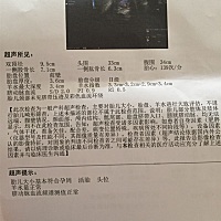 37周加3天，有没有懂的人帮我看看宝宝好不好生？是男孩还是女孩呀？谢谢啦