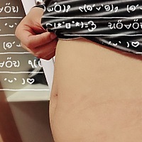 刚满13周啦，这个肚子大小正常吗