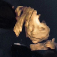 谁会看宝宝五官，看我宝宝颜值怎么样😀😀