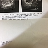 今天突然有点腰酸的感觉，晚上不放心去检查了一下，医生说先兆性流产症状，开了保胎药吃，让十天后去复...