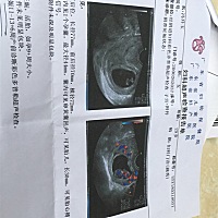 为什么我的检查单子啥数据都看不全？！，有谁能看出男女吗？好期待