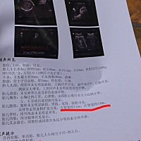 大家好，麻烦帮我看一下这个，37周 3天了，去B超医生说双肾积液，左肾11右肾13。请问有人知道严重吗？是...