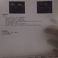 这娃儿杂这么不安份咧，脐带绕颈，你们会不会有这种情况出现啦？