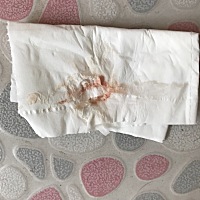 怀孕10周，今天下面见红了，吃的保胎药，亲们看看吃这两种可以吧