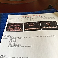 帮我看看这个NT有没有通过.去问医生已经下班了😔宝宝正常吗？