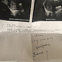 孩子可能没有了，做B超啥都没有，整个人都不好了。等着下午验血结果