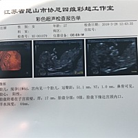 Nt过关，有没有宝妈会看男宝宝还是女宝宝的。好奇。虽然都喜欢