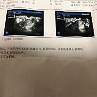 刚刚怀孕5周，小腹很痛阴道流血，该怎么办，求救！