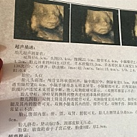 请问会看的亲，这是男宝还是女宝啊，好想知道，哈哈