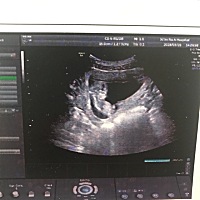 男孩女孩都喜欢，就是比较好奇，麻烦大家帮忙看看