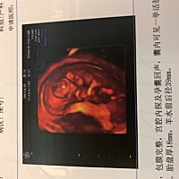 大家有能看出男宝还是女宝吗？