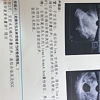 两个月了，什么都还没有，难受，也不知道什么情况