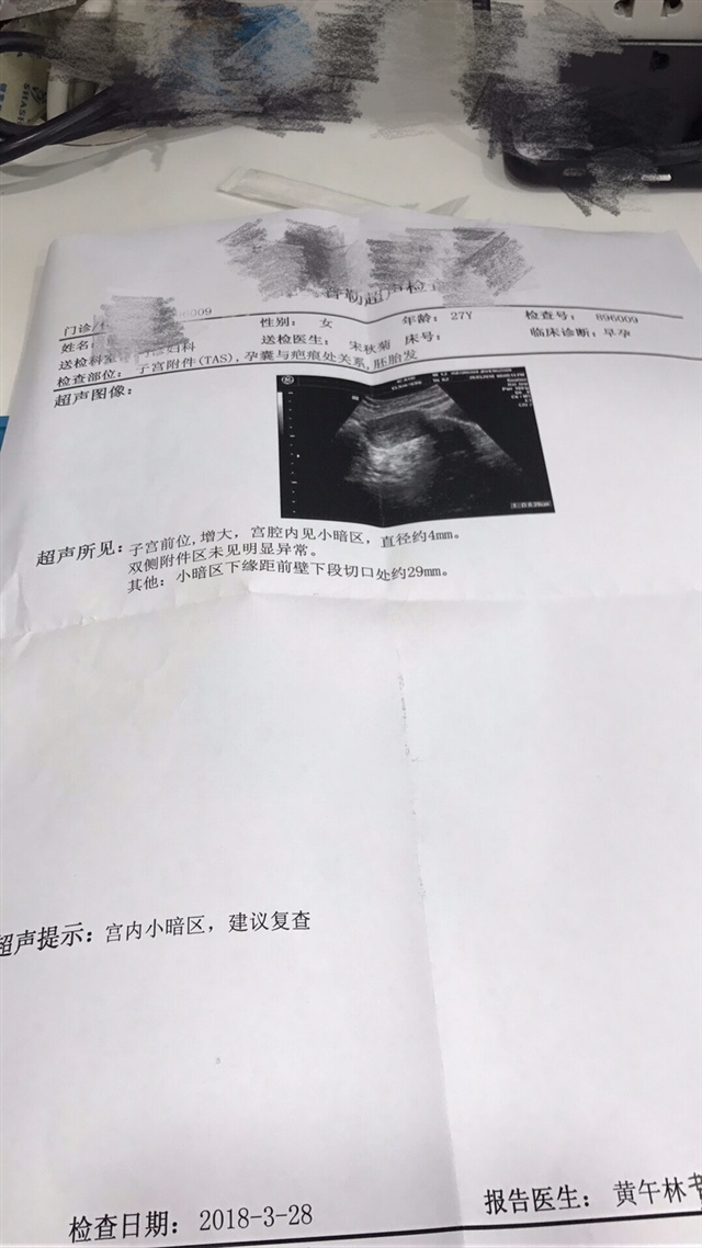 各位小主，孕期显示42天，B超显示很小，正常吗？d
