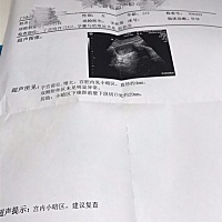 各位小主，孕期显示42天，B超显示很小，正常吗？d