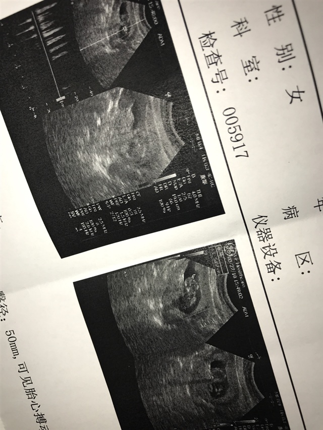 好奇 来凑个热闹问一下 男宝女宝呀😄