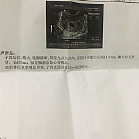 拜拜啦 没准备好你来了 ，但是你又走了！下次调理好身体迎接一个健健康康的你！