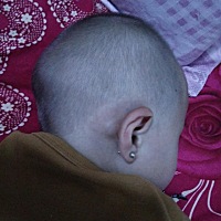 1岁半宝宝耳朵边上长了个包包一样到底是什么，以前就有一点点那时没注意以为是上火了，最近才发现比较大...