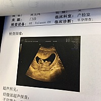 大儿子都14岁了  小儿子10个多月就意外又怀了一个  希望生个女儿吧  这样将来即可以做奶奶也可以做外婆