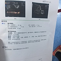 请会看的宝妈看看是男宝还是女宝，好奇心！