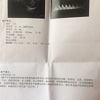 有没有大神会看这是男孩女孩呀？虽然马上要生了还是特别好奇.......