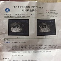 怀孕64天照，有点好奇是男孩还是女孩，怀孕圈子里的亲们有没有懂的，请帮我看看😂