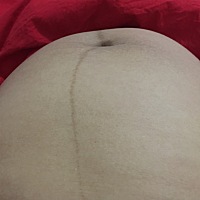 数胎动 拿着手机想拍视频这熊孩子不动了 去医院做胎心监护拿着手机也不动 医生说要少玩手机 宝妈们你们...