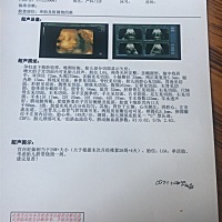 四维彩超，能看出男女吗😳，大家帮帮忙看看，好奇啊，