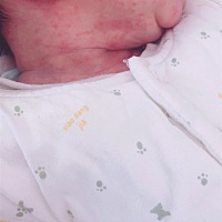 宝宝脖子都长这东西 是什么 有什么办法可以治疗