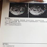 这种情况怎么办，好想要这个宝贝