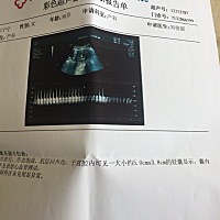 请问一下孕妈，我这有几个月