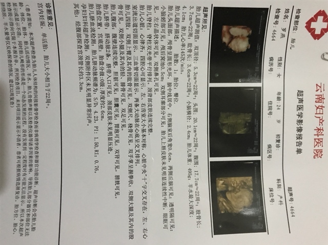 四维B超过了。麻烦大家帮忙看看是男孩 还是女孩。