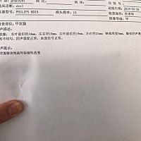 今天查了甲状腺，两个抗体很高，有一样的吗？