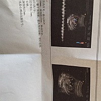 正常么？心跳会不会太快，看的出男女么