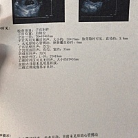 8周了没有胎心，还要不要等了，真的好难过