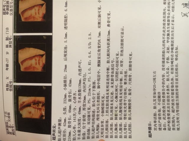 好想早点看到宝宝