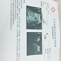 刚怀孕不久，我也不太懂，麻烦各位亲们帮忙看下，谢谢。