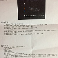 大家帮帮忙看看男宝或是女宝呀？